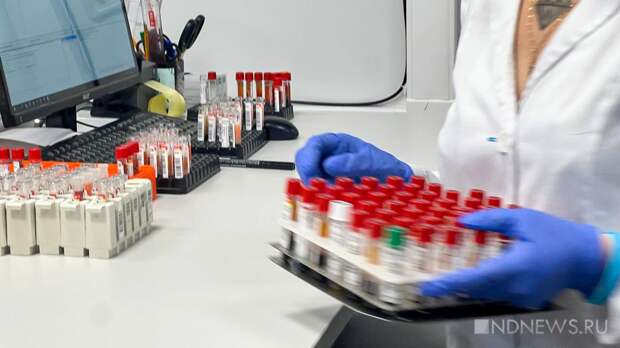 На Урале снижается заболеваемость ВИЧ – но зараженных все равно вдвое больше, чем по стране