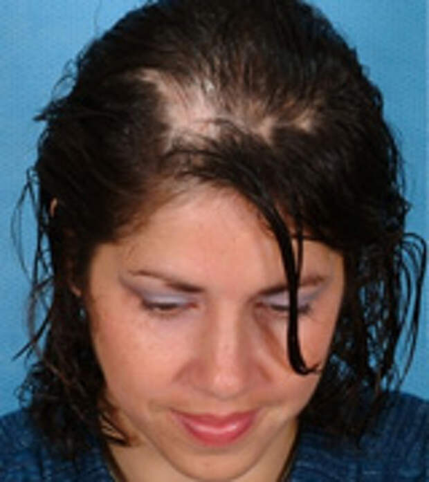 Фото волосы на теле женщины