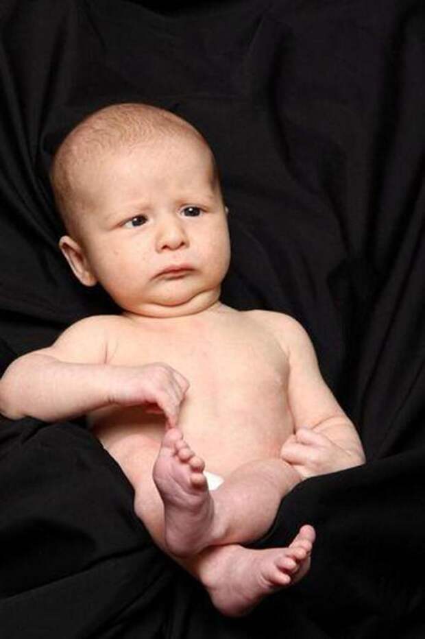 WorstBabyPhotos10 Эти ужасные младенцы