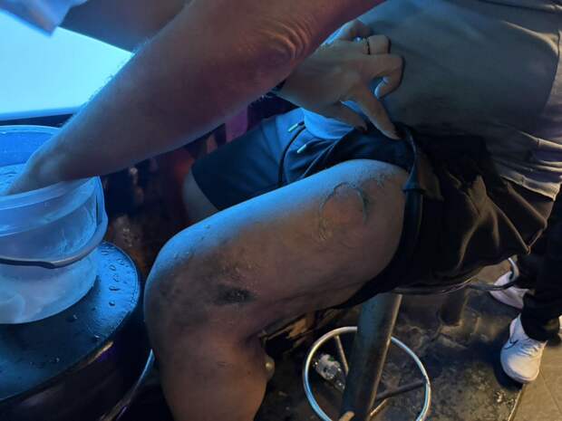 Брюки отдыхавшего в Таиланде туриста загорелись в пивном баре из-за одного предмета