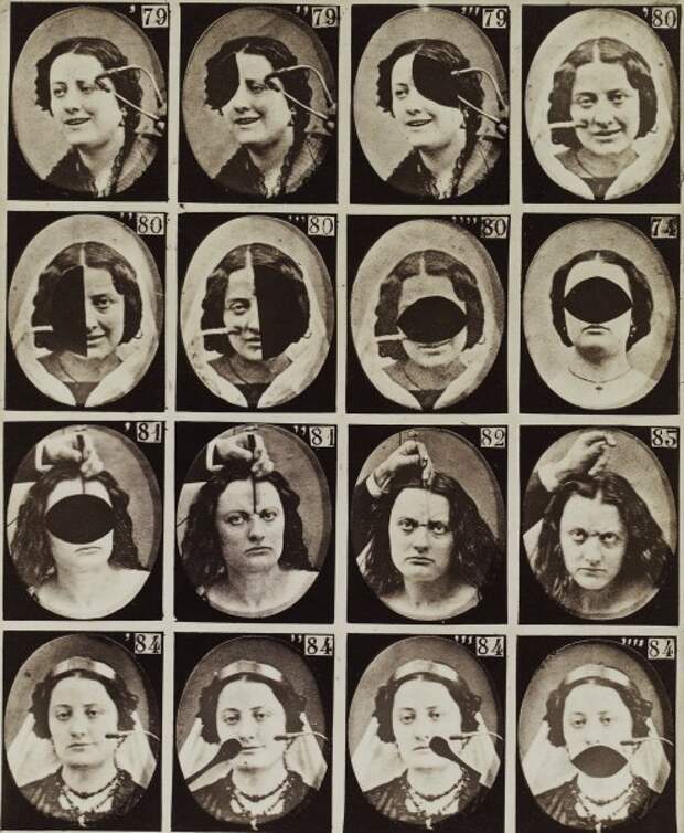 Леденящие душу старинные фотографии экспериментов по неврологии (25 фото)