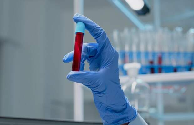 Гематолог поведал, как часто надо сдавать кровь, чтобы не пропустить болезнь