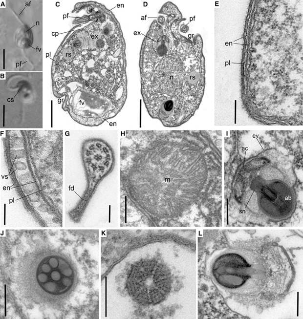 Рис. 3. Особенности строения небулиды Ancoracysta twista