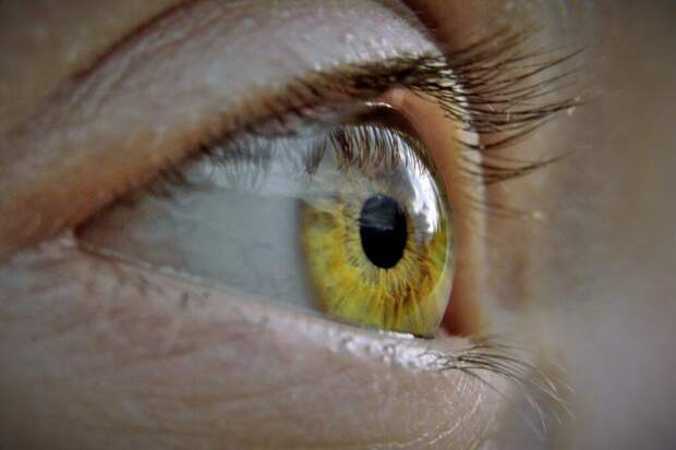 Не вода и не возраст: три неочевидные причины мешков под глазами