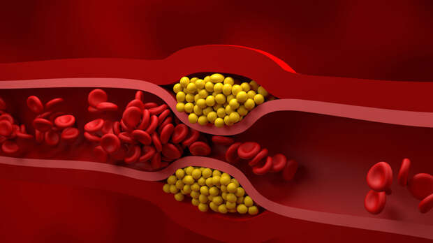 Врач Хорошев: риски поражения артерий возрастают с 40 лет