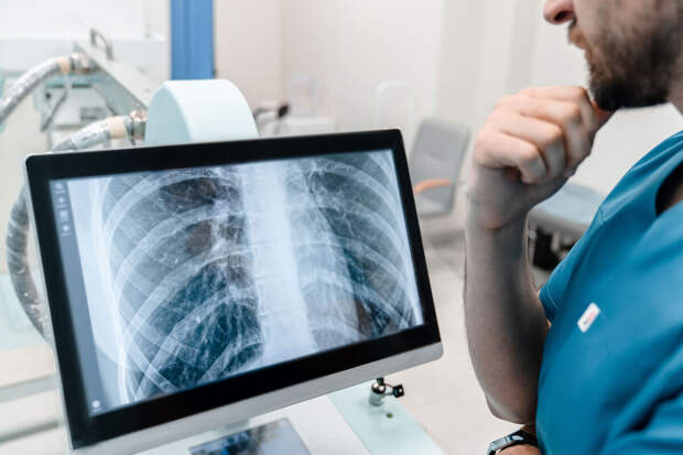 В МФТИ создают антибиотики, которые избирательно убивают возбудителя туберкулеза