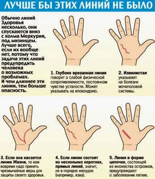Определить заболевание по рукам. Хиромантия. Болезни по руке человека. Знаки болезней на ладони хиромантия.