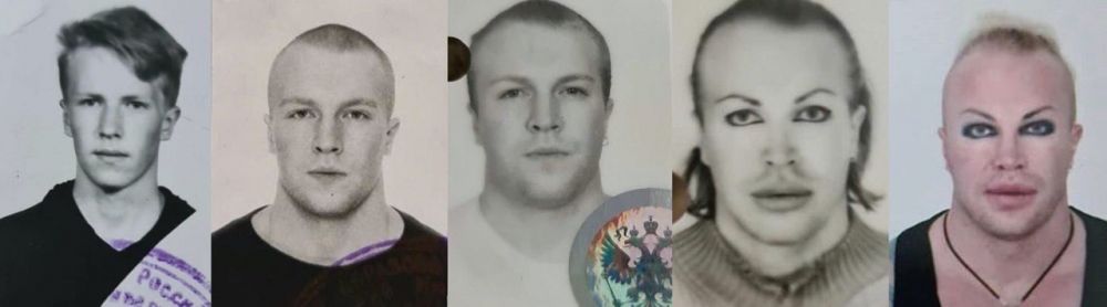 Вот как выглядел Александр Шпак до всех операций