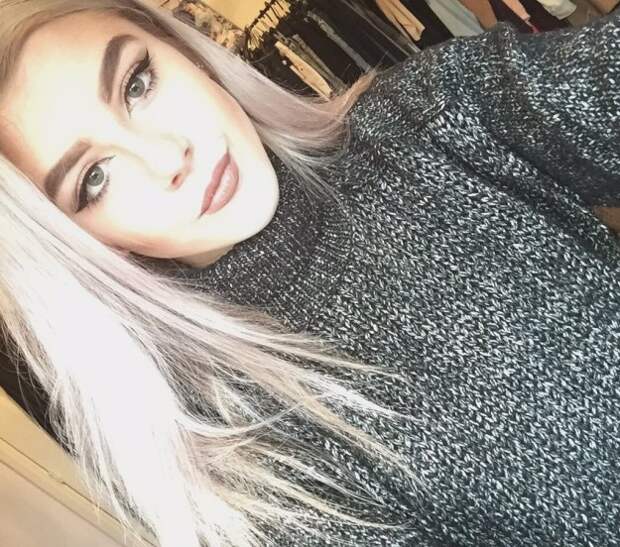 Abbi Price, a teenager from Coventry, UK, turned 18 last week.
