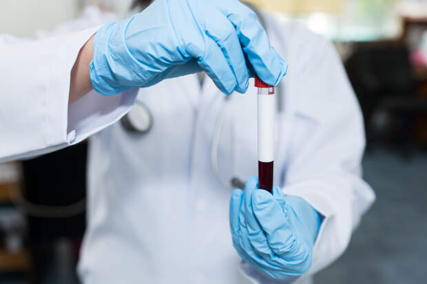 Россиян призвали отказаться от сдачи шести бесполезных анализов
