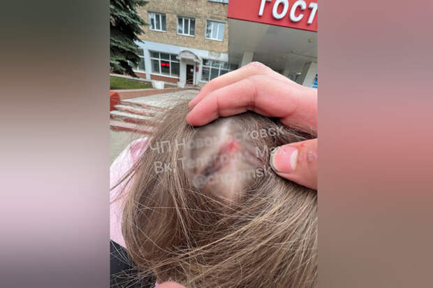 СК завёл уголовное дело после нападения на подростка в автобусе в Новомосковске