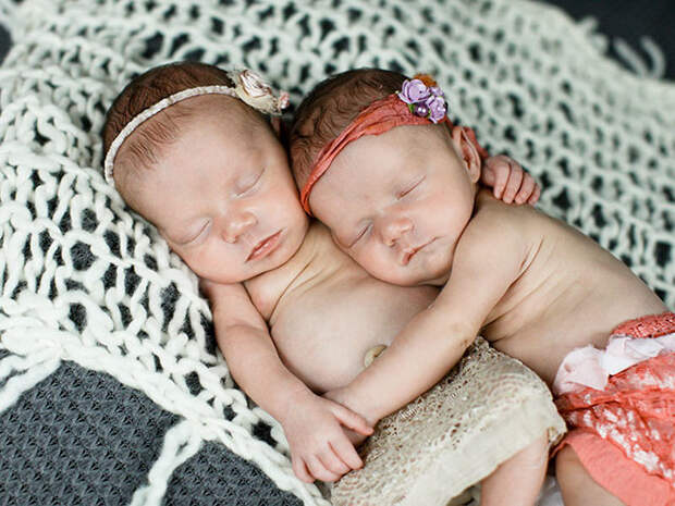 Близняшки, родившиеся держась за руки, и спустя 2 года невероятно близки близняшки, дети, за руки