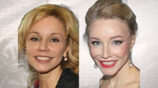 «Птичий рот» и «восточная маска»: как 6 известных красавиц изменились после вмешательства пластики