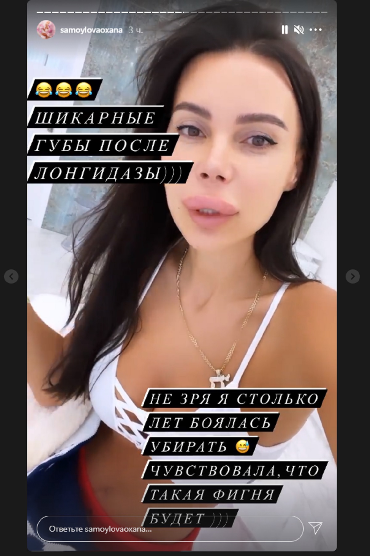 Жена Джигана шокировала поклонников распухшими губами