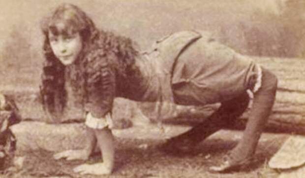 История Эллы Харпер, прославившейся как «девочка-верблюд»