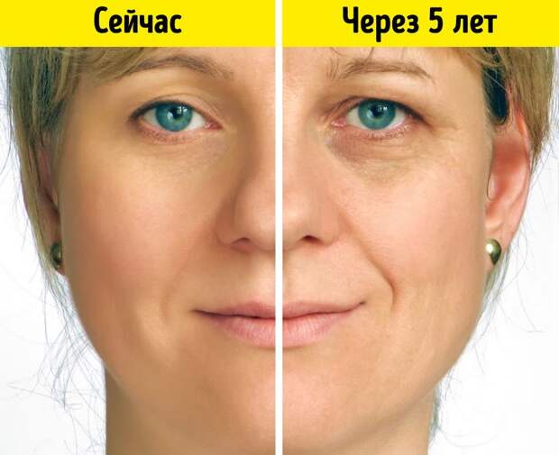 Как неправильный прикус влияет на самочувствие и внешность