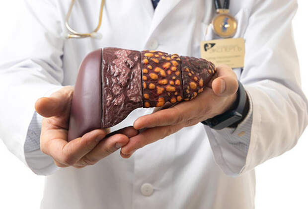 Metabolism: Популярный витамин оказался полезным при жировой болезни печени