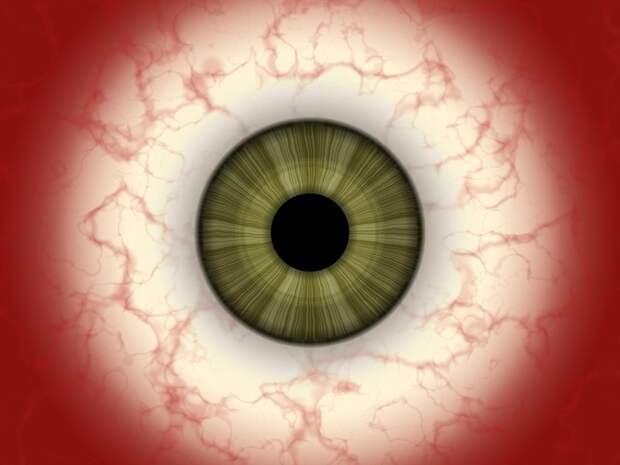 Cиндром «красного глаза»