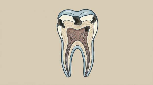 Стоматолог Поляков: из-за запущенного кариеса можно попасть в реанимацию