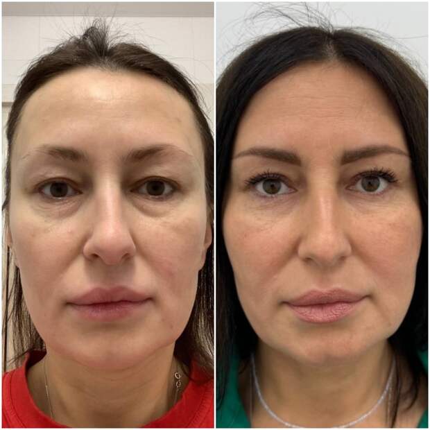 MyCollages - 2024-06-26T192521.507