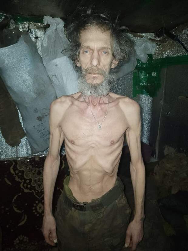 Черви вместо пайка: на Купянском направлении бойцы ВСУ болеют дистрофией, на грани выживания