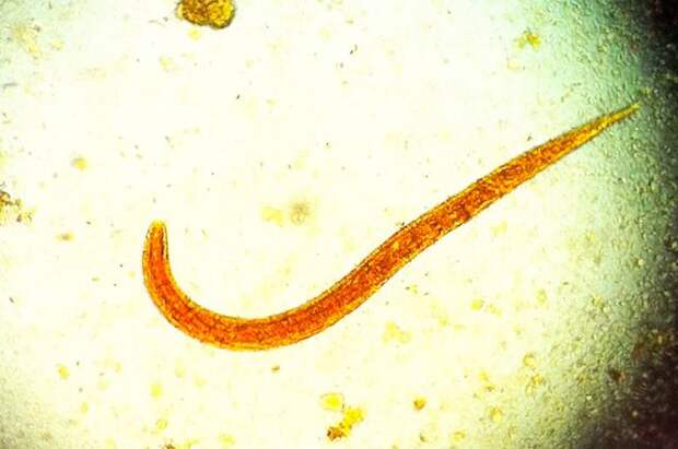 Почему не стоит гулять босиком по земле