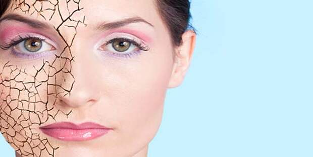 dry-and-dull-face